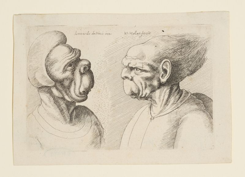 Two Deformed Heads with Very Long Upper Lips