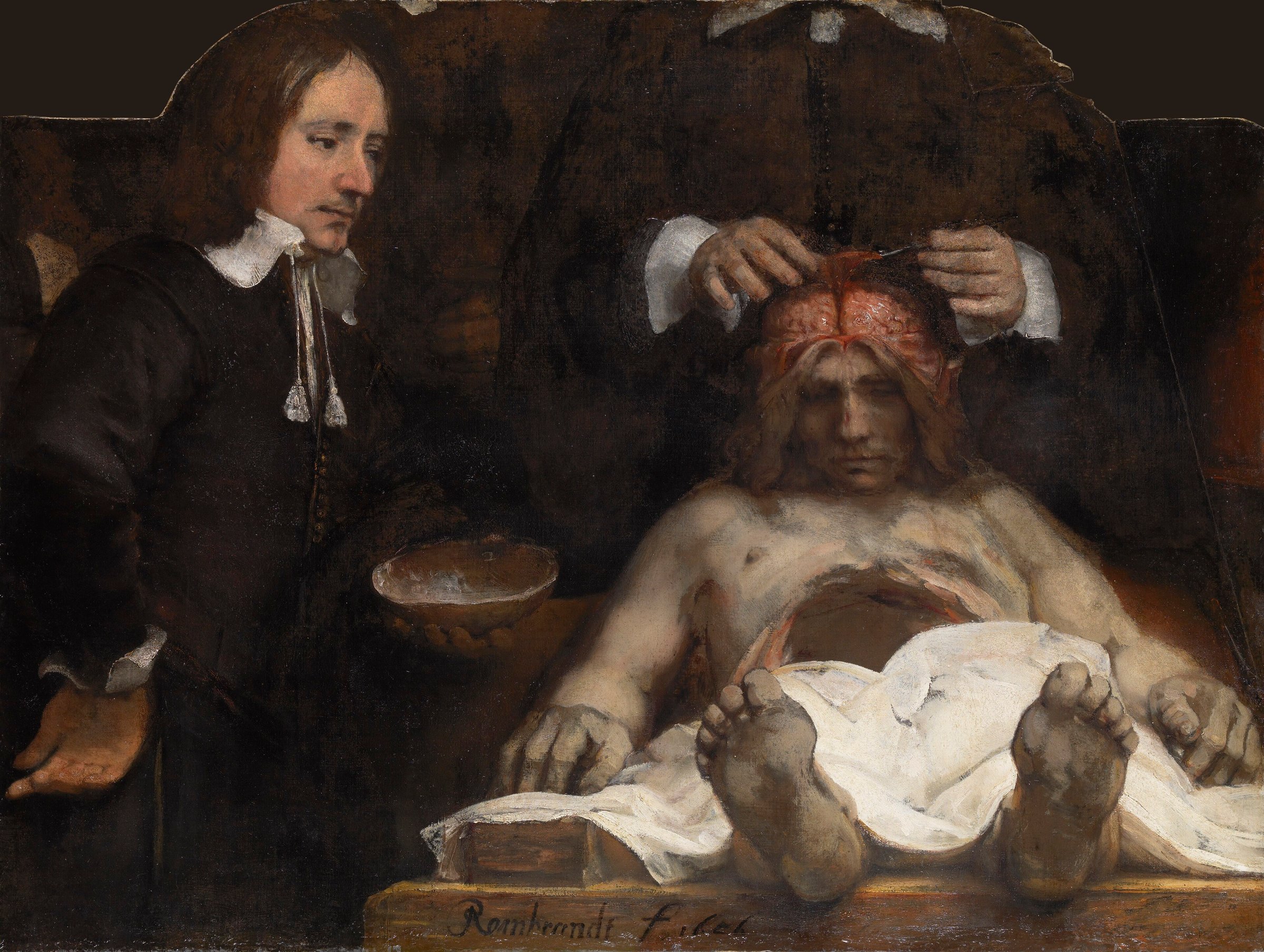 The anatomy lesson of Dr. Joan Deijman by Rembrandt